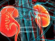 Pakistan's Healthcare System Struggles with Rising Kidney Disease Burden