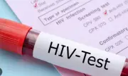 Pakistan HIV cases reach 250,000, 80% patients lack treatment access