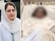 Dr Mahnoor's First Surgery After Acid Attack Successful in Karachi