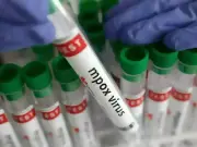 Karachi Reports Ninth Mpox Case; Patient Admitted to Isolation Ward
